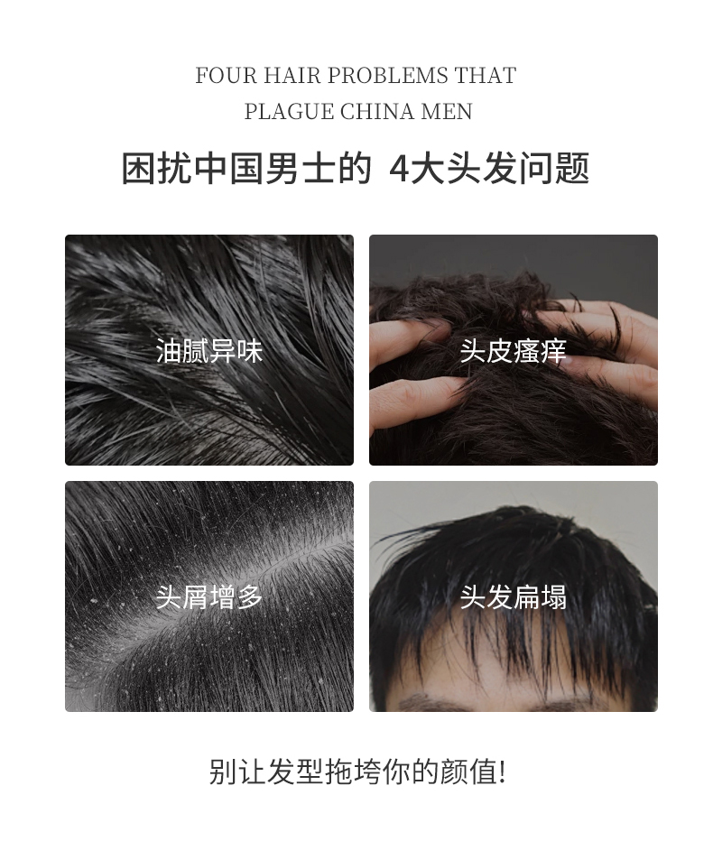 困擾中國男士的四大問題，油膩異味、頭皮瘙癢、頭屑增多、頭發(fā)扁塌